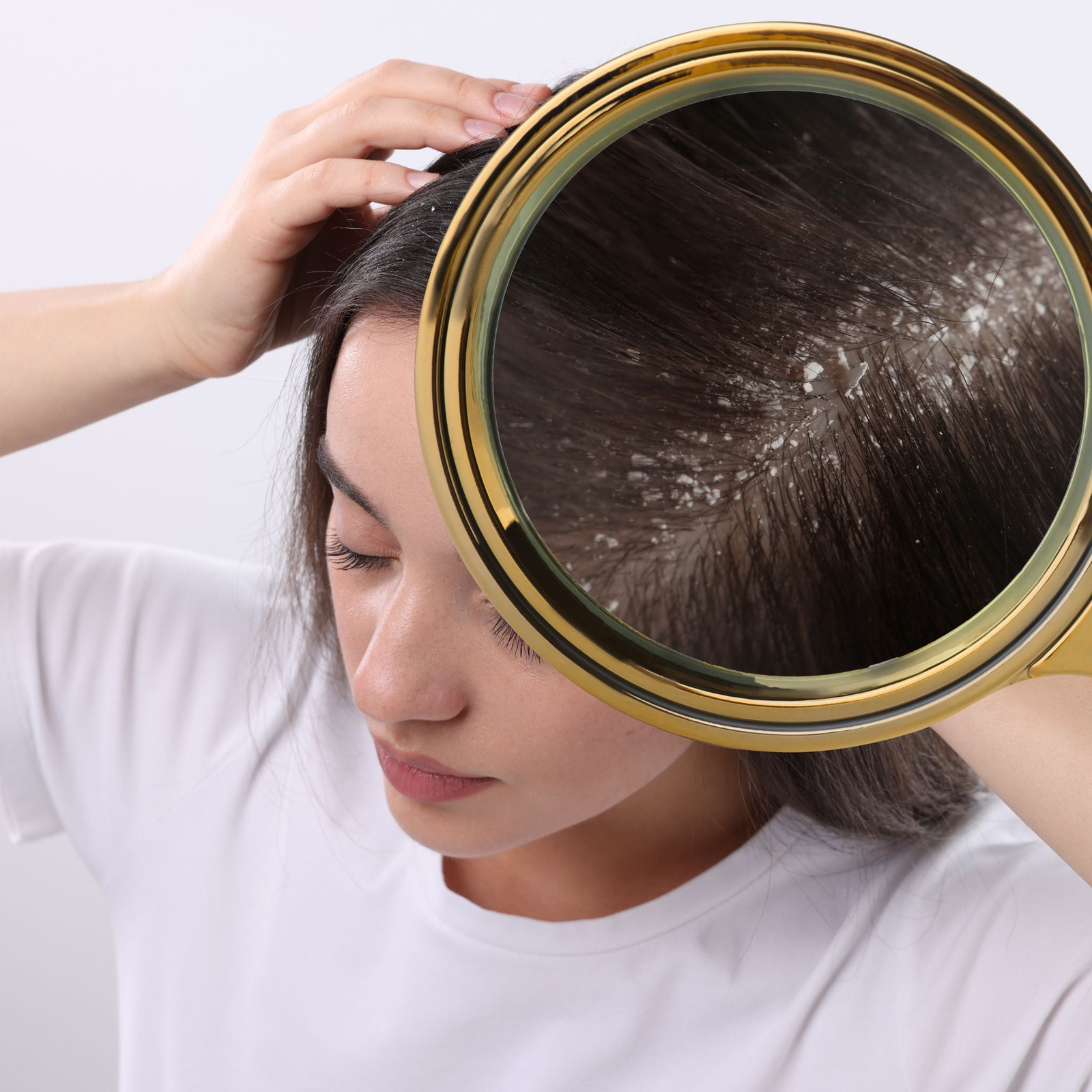 PRODUCTS FOR OILY/ DANDRUFF/ FLAKY/ ITCHY SCALPS